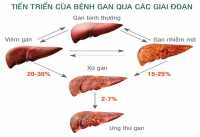 Giải độc gan hiệu quả bằng cây an xoa