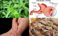 Địa chỉ mua bán cây lược vàng khô hỗ trợ chữa bệnh ung bướu